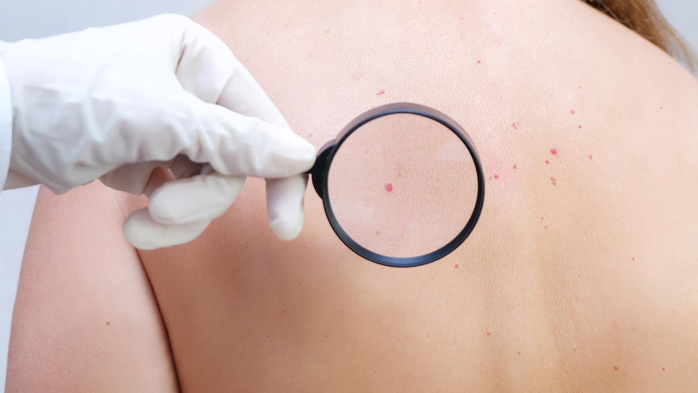 Dermatolojik Muayene